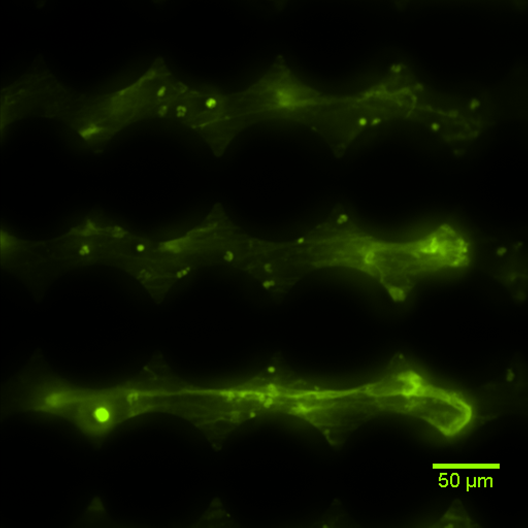 Detection of extracellular DNA in a wound model (in cooperation with the Institut für Festkörperelektronik of the TU Dresden)